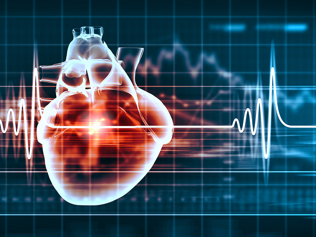 Lekari Instituta Dedinje prvi put u Srbiji pulsnom energijom savladali najčešću aritmiju srca