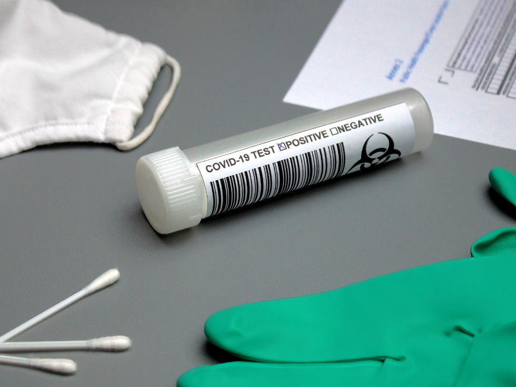 Mađarska donira Crnoj Gori 10.000 PCR testova