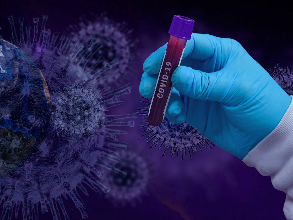Zavod za javno zdravlje u Zrenjaninu dobio kao donaciju aparat za obradu testova na prisustvo koronavirusa