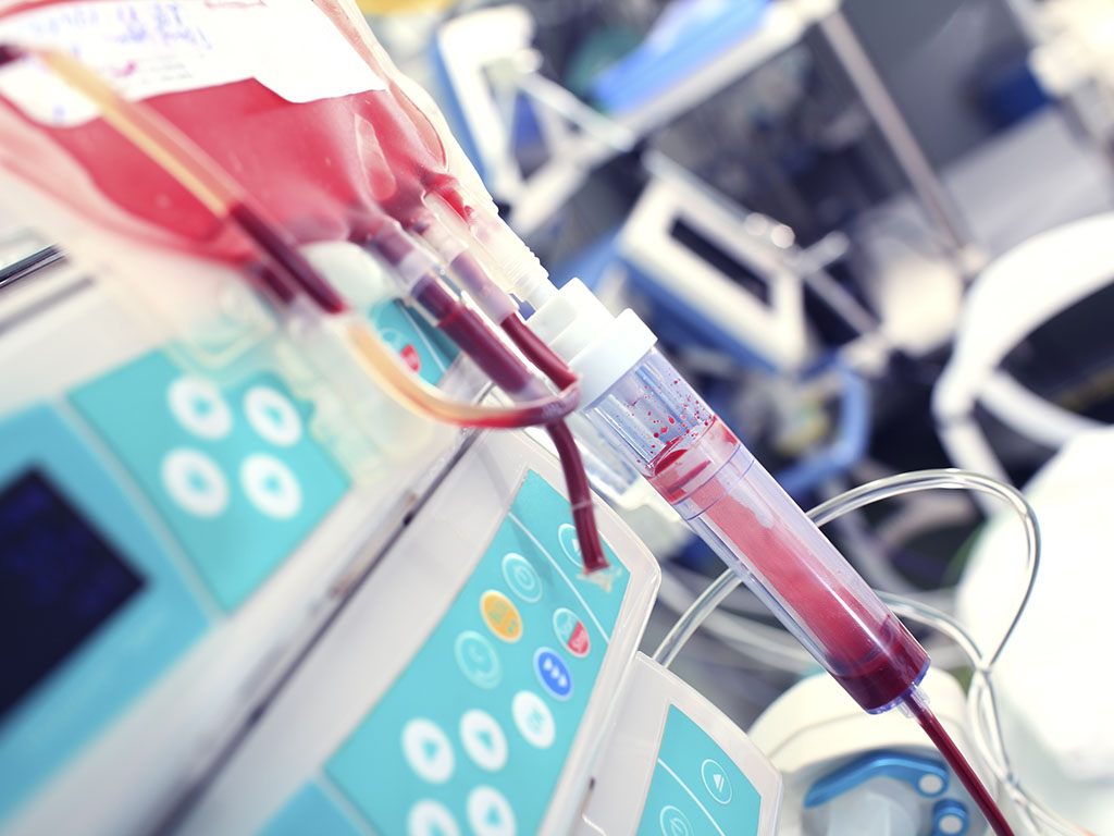 Slovačka donirala 10.000 EUR Zavodu za transfuziju krvi