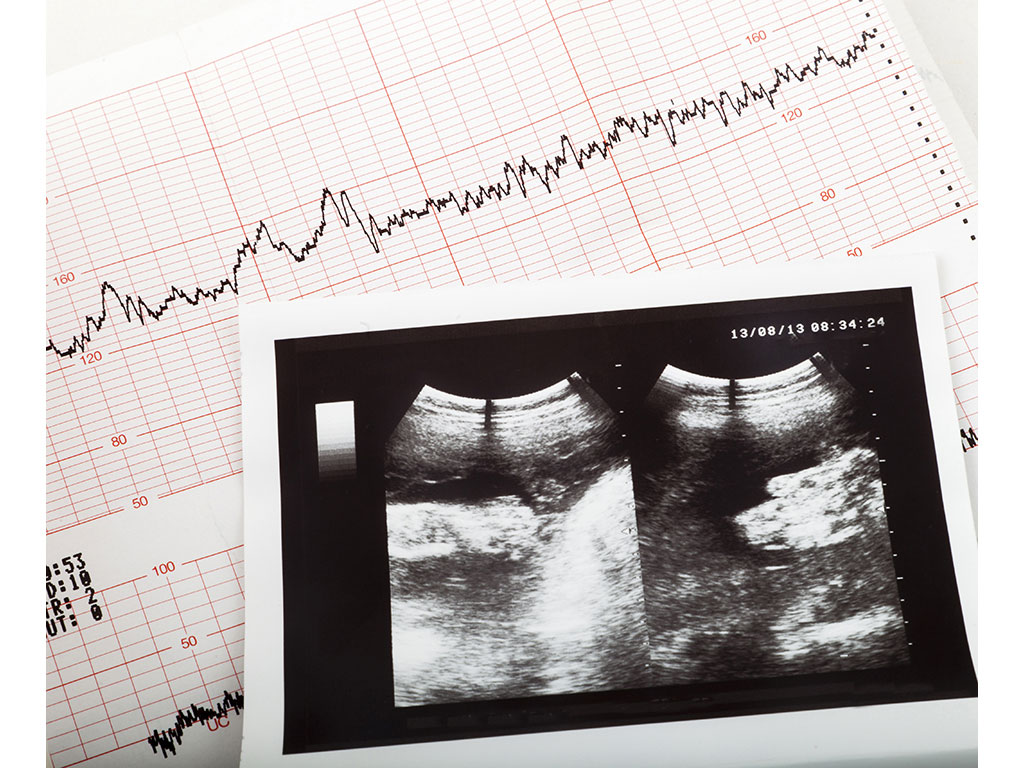 Kompanija Glosarij donirala ultrazvuk opštoj bolnici na Cetinju